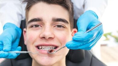 لق شدن روکش دندان میتواند نشانهای از پوسیدگی پنهان باشد