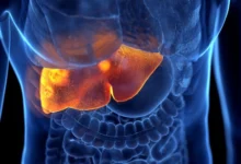 بیماری کبدی