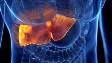 بیماری کبدی